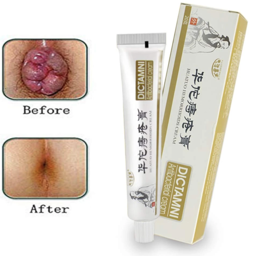 Traditional Chinese Herbal Hemorrhoid Cream